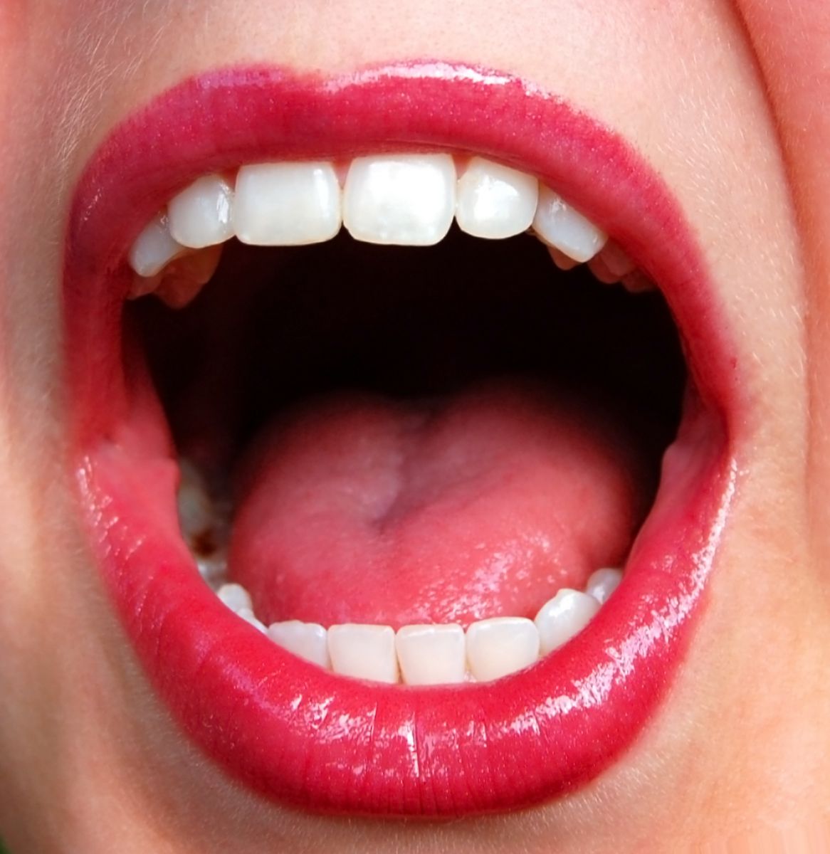 Проявления специфических инфекций (туберкулез, сифилис) в полости рта