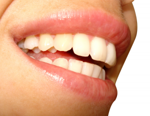 Белоснежные зубы
