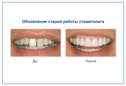 Обновление старой работы стоматолога