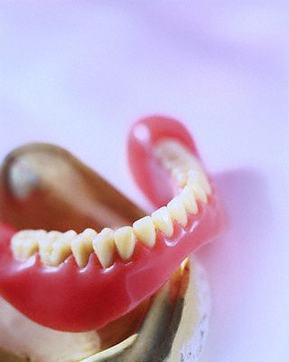Съемные зубные протезы