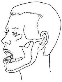 Центральное положение нижней челюсти