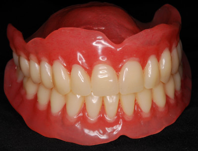 История протезирования съемными пластиночными протезами при полном отсутствии зубов 
