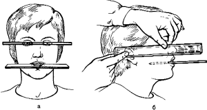 Анатомо-физиологический метод определения центрального соотношения челюстей