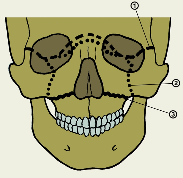 Морфологические особенности верхней и нижней челюстей с полным отсутствием зубов