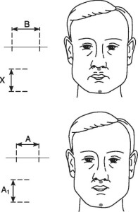 Фотографический метод определения высоты нижнего отдела лица