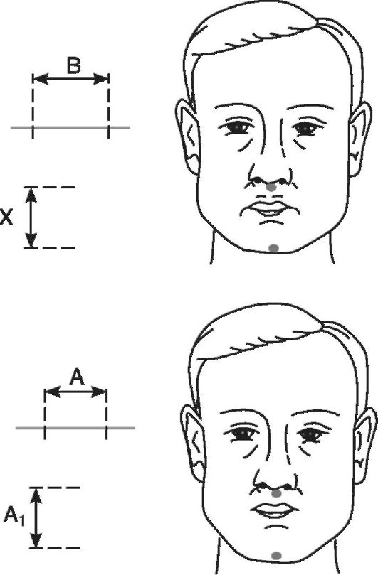 Фотографический метод определения высоты нижнего отдела лица