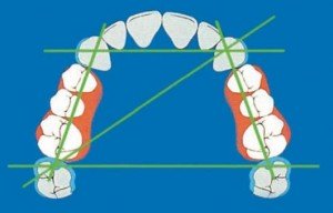 Ориентиры, используемые при конструировании искуственных зубных рядов