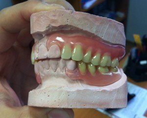 Эстетические аспекты при постановке искусственных зубов