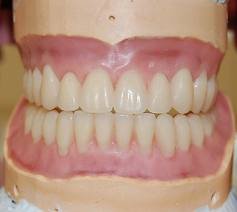 Дополнительные рекомендации по индивидуальной постановке искусственных зубов