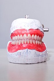 Пришлифовывание искусственных зубов. Изменение формы верхних передних зубов в зависимости от пола пациента