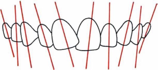 Конструирование искусственных зубных рядов по индивидуальным окклюзионным кривым
