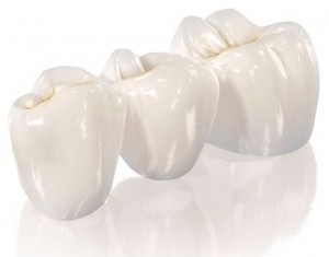 Безметалловая керамика в стоматологии