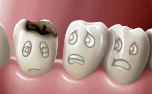 У кого может развиваться кариес зубов?