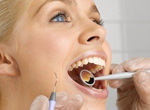 Часто задаваемые вопросы насчет лечения зубов