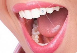 Современная эстетика в стоматологии