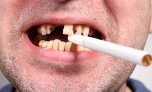 Курение меняет микрофлору полости рта