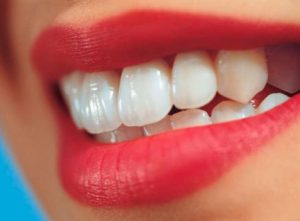Реставрация зубов в Сумах
