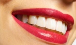 Идеальная улыбка: четыре секрета красивых зубов
