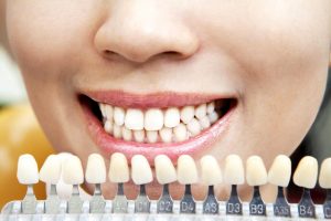 Факторы, которые влияют на цвет зубов