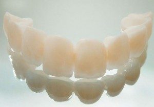 Временные коронки на зубы