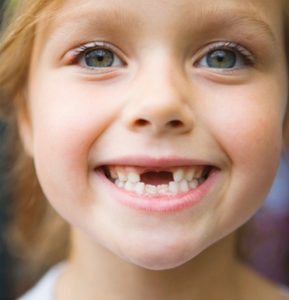 Ребенок потерял постоянный зуб. Что делать?