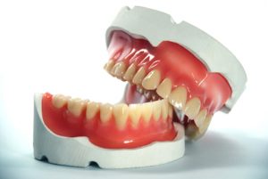 Протезирование зубов или восстановление?