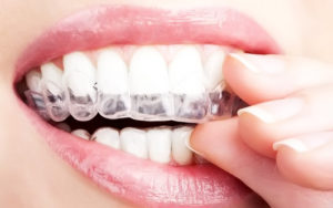 Как долго зубы будут белыми?
