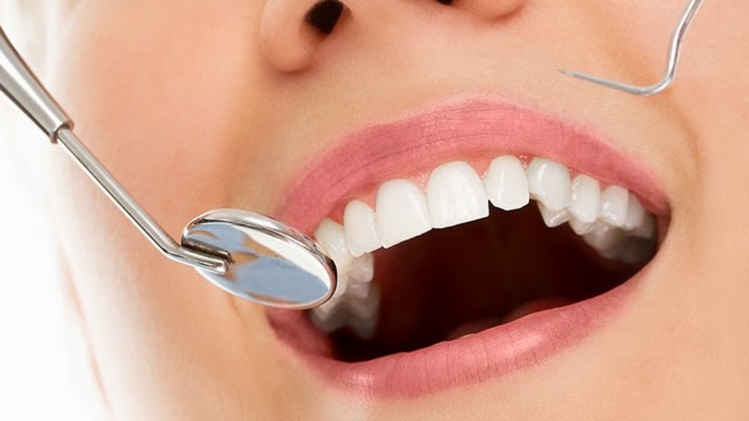Відбілювання зубів в Сумах